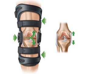 Freestyle OA Knee Brace – Saana PainCare